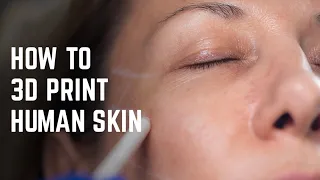 3D bioprinting human skin