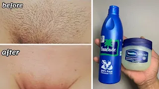 Stop shaving! Here's how to permanently get rid of unwanted hair . facial and body hair.