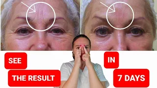 Get rid of FROWN LINES | Reduce FOREHEAD WRINKLES