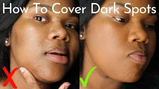 How to cover acne/dark spots/hyperpigmentation WITHOUT a lot of makeup| BareMinerals Powder Tutorial