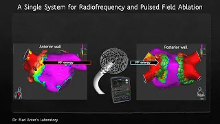 Dr. Elad Anter's Laboratory: A novel Technology for Atrial Fibrillation Ablation published in Circ.