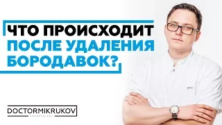 Что происходит после удаления бородавок? #удалениебородавок #удалениебородавокростов