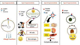 Hypersensitivity types  in 4 minutes