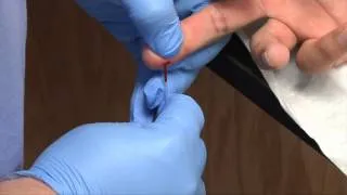 Phlebotomy: Dermal Capillary Punctures | Blood Collection (Rx-TN)