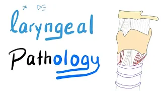 Laryngeal Pathology | Singer 👨‍🎤 Nodule, Laryngeal Paipilloma, and Laryngeal Cancer