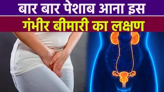 बार बार पेशाब आना Overactive Bladder के Symptoms, क्या है कारण और उपाय |Boldsky