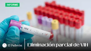 Eliminación parcial de VIH en celulas infectadas | El Pailetón