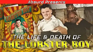 The Life And Death Of The Lobster Boy