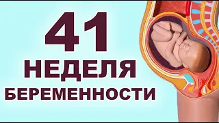 Что происходит с ребёнком и мамой на 41 неделе беременности?  Последние дни перед родами.