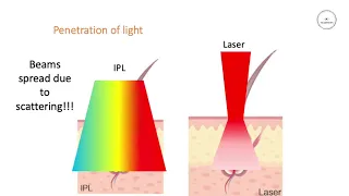 Difference between laser and IPL hair removal