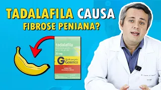 USO PROLONGADO DE TADALAFILA CAUSA FIBROSE PENIANA? | Dr. Claudio Guimarães