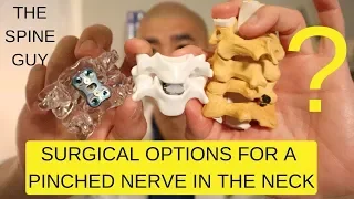 CERVICAL STENOSIS RADICULOPATHY - PART 3 - SURGICAL OPTIONS