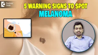 5 Warning Signs of Melanoma|Melanoma & Skin Cancer Awareness Month-Dr.Rajdeep Mysore|Doctors' Circle