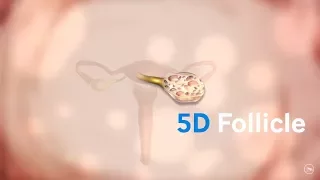 5D Follicle – пакет автоматического определения фолликулов и их размеров