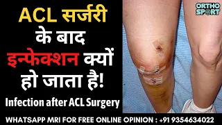 #ACL सर्जरी के बाद इन्फेक्शन क्यों हो जाता है ! Knee Infection after ACL #Ligament Surgery