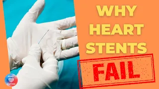 WHY heart stents FAIL?