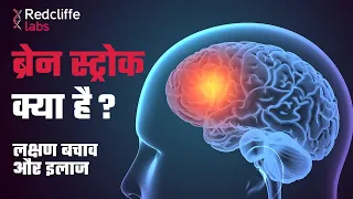 Brain Stroke Kya hota hai Aur kyu hota hai | Brain Stroke स्टोक के लक्षण बचाव और इलाज | #Redcliffe