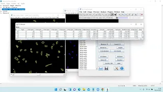 Cell Volume and morphology analysis with 3DSuite (ImageJ)