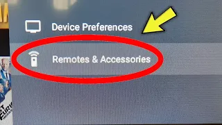 OnePlus Android Tv || Remote & Accessories Setting Yseries