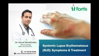 Lupus Signs & Symptoms (& Why They Occur) | Skin, Joints, Organ Systems #lupus #arthritis #cervical