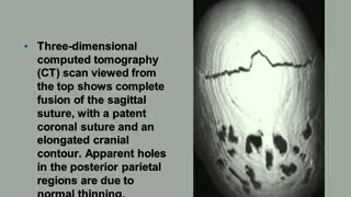 SKULL ANATOMY NORMAL ANATOMY Dr/AHMED EISAWY