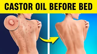 12 POWERFUL Reasons Why You Should Use Castor Oil Before Bed!