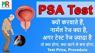 PSA ( prostate specific antigen ) test in hindi | PSA test normal range | PSA test क्या होता है,