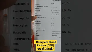 Complete Blood Picture (CBP) అంటే ఏమిటి ? Dr Sai Chandra