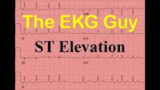 EKG/ECG ST Elevation - Question 25.0 | The EKG Guy