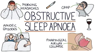 Obstructive Sleep Apnoea