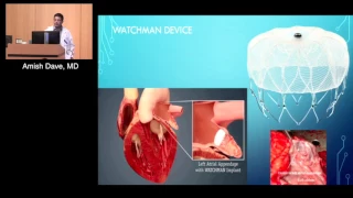 Optimizing Heart Failure with Electrophysiology Interventions (Amish Dave, MD)