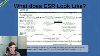 Central Sleep Apnea Explained