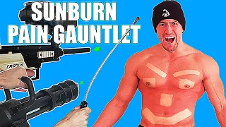 Extreme SUNBURN Pain Gauntlet *PEAK SUFFERING ACHIEVED* | Bodybuilder VS Sunburn Slapping Experiment