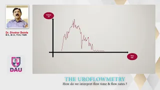 Uroflowmetry How to interpret Flow rates and times