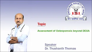 Assessment of Osteoporosis beyond DEXA by Dr. Thushanth Thomas