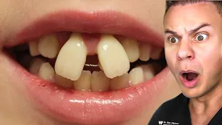 TikToks That Will Make You NOT Want Braces