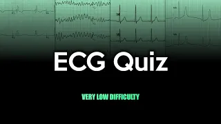 ECG Quiz: Very Low Difficulty