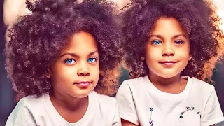 Remember the Most Beautiful Black Twin Girls in the World? You Won't Believe How They Look Now!