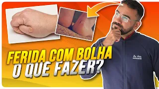 BOLHA, O QUE FAZER? ESTOURA OU NÃO? (APRENDA AGORA)