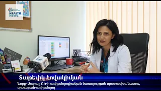 ՍՐՏԻ ԱՌԻԹՄԻԱ․ ՊԱՏՃԱՌՆԵՐԸ ԵՎ ԲՈՒԺՈՒՄԸ