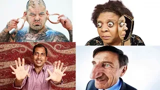 10 Of The World’s Biggest Human Body Parts | Top 10 Huge Body Parts Of Humans