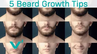 5 MUSTS For Growing A Better Beard