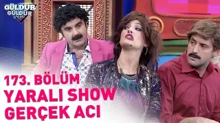 Güldür Güldür Show 173. Bölüm | Yaralı Show - Gerçek Acı