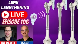 Limb Lengthening LIVE Episode 106 - Discussing the PRECICE Max Nail with Dr. Paley
