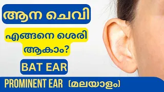 Otoplasty in Kerala (Malayalam)|| prominent ear/ bat ear correction, Dr prince plastic surgeon