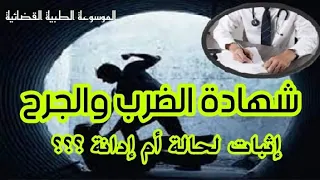 شهادة الضرب والجرح العمدي؛ إثبات حالة أم إدانة للفاعل؟؟؟