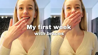 my first week with braces: what I ate, did I feel any pain?