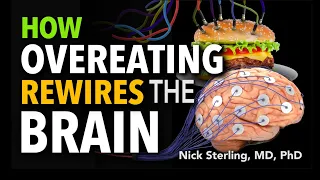 How Overeating Rewires Our Brains – Neuroscience of Weight Gain & Loss | Nick Sterling, MD, PhD #4