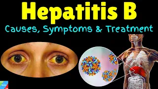 Hepatitis B – Symptoms, Causes, Risk Factors, Pathophysiology, Diagnosis, Treatment