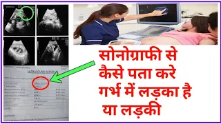 Sonography se kese pta kre Boy hai ya girl ! सोनोग्राफी से कैसे पता करे गर्भ में लड़का है या लड़की ??